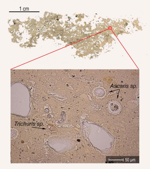 1 parasiteeggs