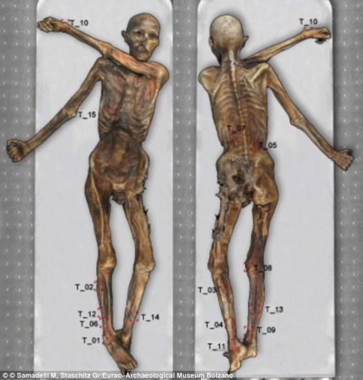 25115c1200000578 2926437 in total the hunter has 61 tattoos grouped acorss 19 body parts a 4 1422264719360