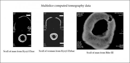 Inside multislice tomography