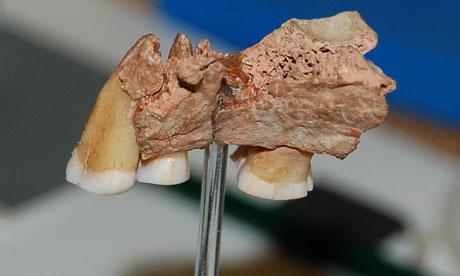 jawbone-with-three-teeth-007.jpg