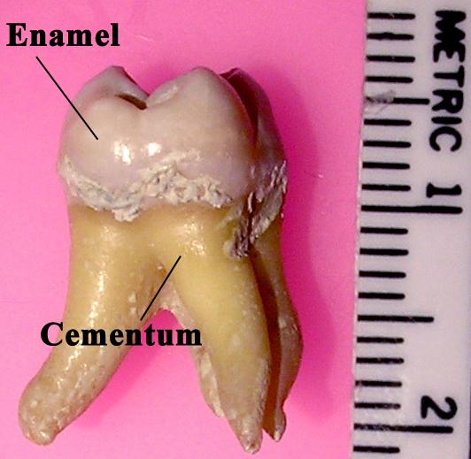 Labeledmolar