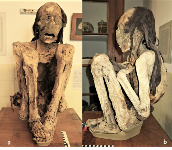 Low res frontiers medicine south american mummies 1 jpeg