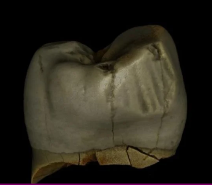 Neanderthal premolar