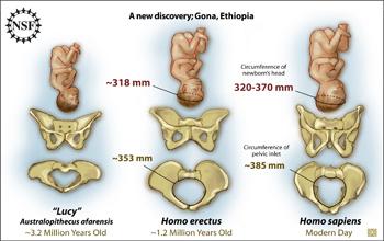 pelvis1-f1.jpg