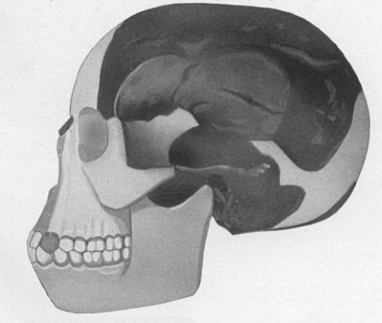 Piltdown man