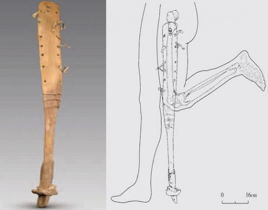 Prosthetic leg china tomb