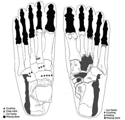Sacred ridge foot bones