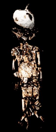 Scanning the pharaohs fetus 5mo daughter of tut 3d ct 433x1024