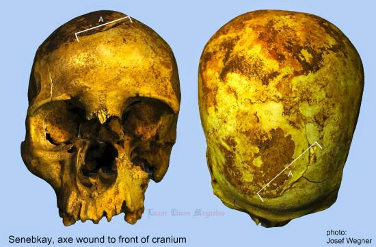 Senebkay discovered skelton by upenn josef wegner by luxor times 5