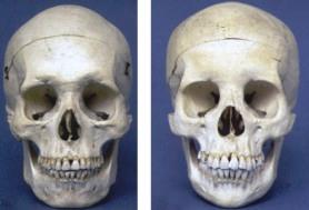 skull-frontal-male-female2.jpg