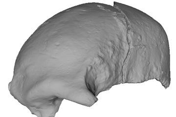 Skull scan