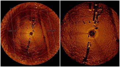 Sonar image