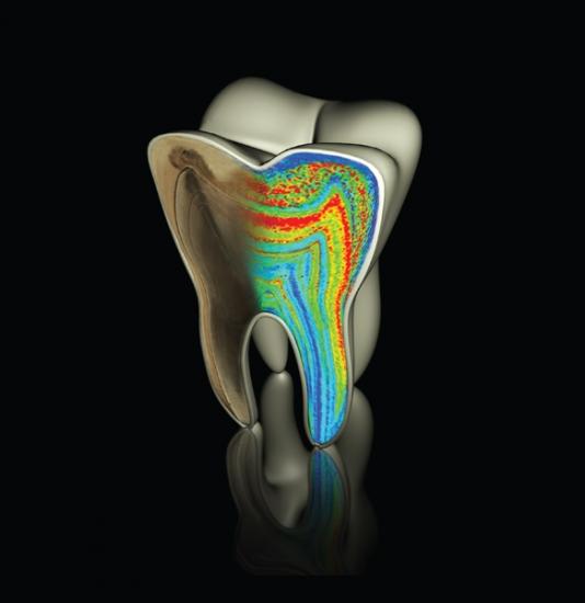 web-figure1-neanderthal-tooth.jpg