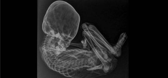X ray of the peruvian mummy